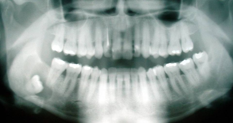 Driving south could slash dental bills
